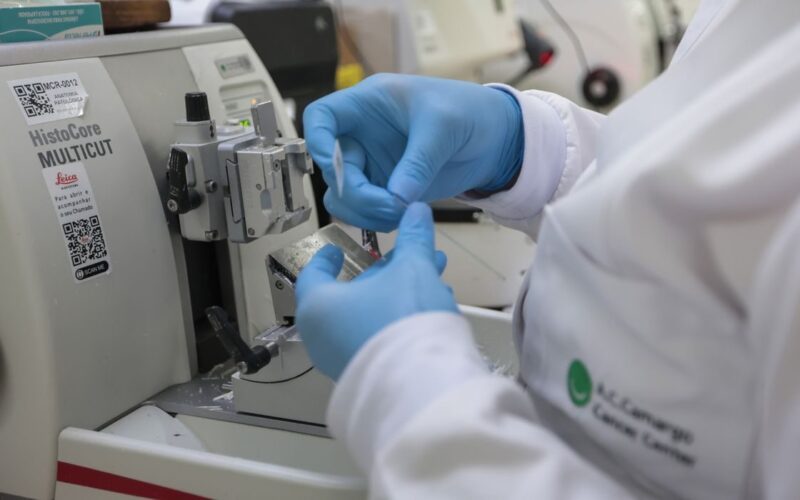 Novo tratamento promete taxas de cura de 98% para o câncer de próstata