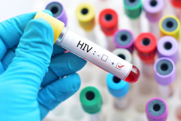 Explorando novas possibilidades para a cura do HIV