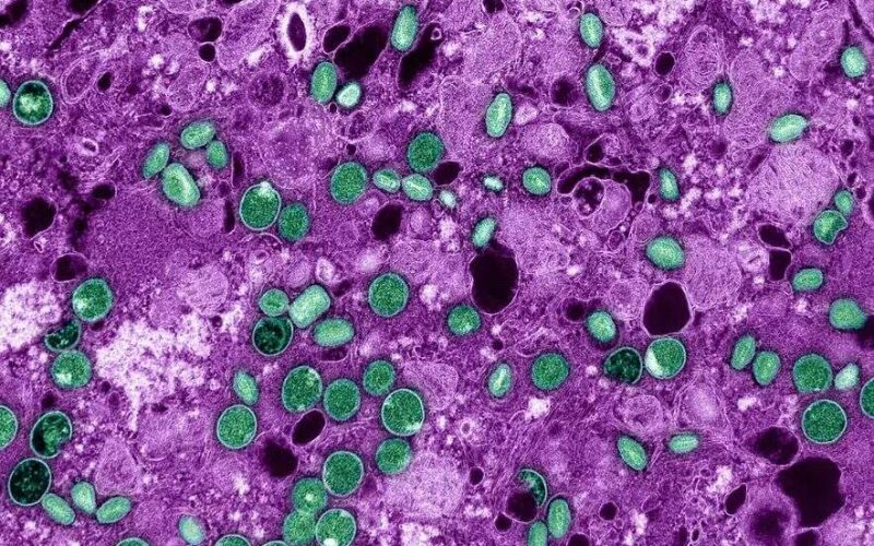 Mantenha-se seguro: dicas para se proteger do vírus Mpox