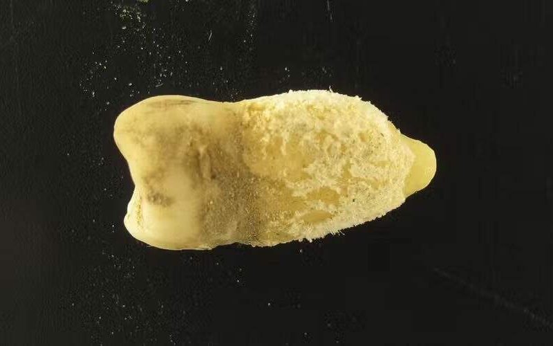 Bactéria da escarlatina encontrada em múmia da era pré-colombiana: implicações e novidades sobre a descoberta