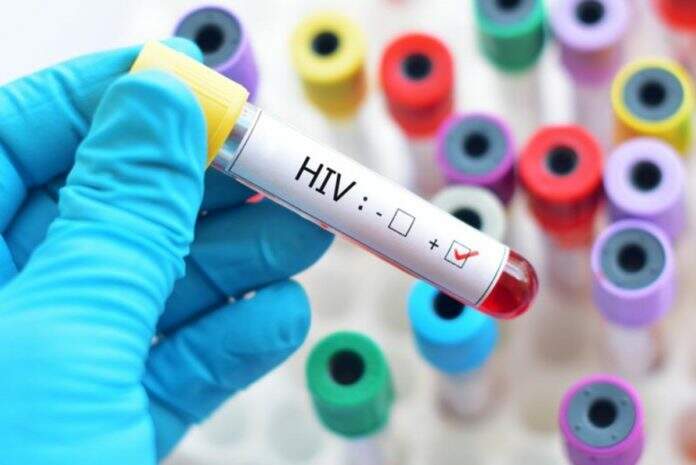 Desconhecimento sobre drogas preventivas do HIV preocupa até especialistas da saúde, segundo médico