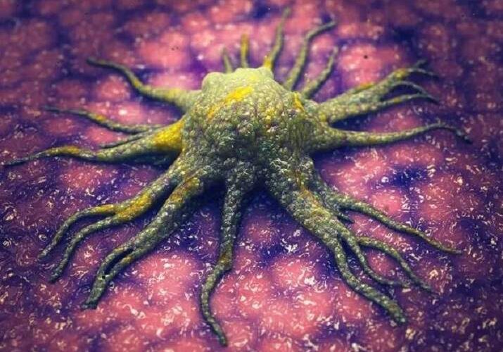 Nova molécula é capaz de inibir células cancerígenas sem prejudicar os tecidos saudáveis