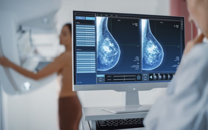 SUS implementa teste genético para detecção de mutações hereditárias relacionadas ao câncer de mama