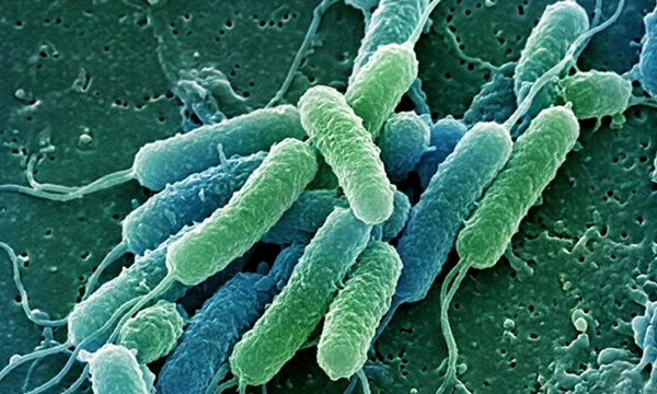 Contaminação em produtos da Ypê representa ameaça para pessoas imunocomprometidas