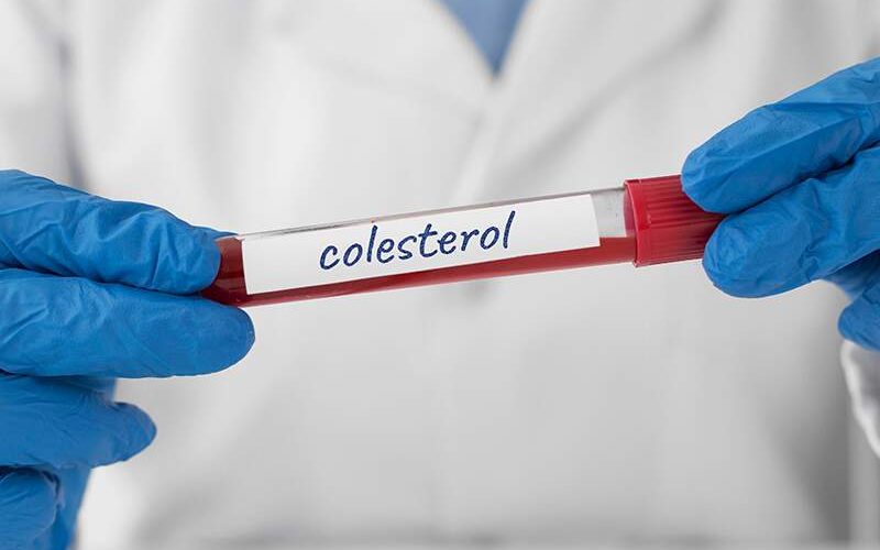 Técnica de edição genética surge como promissora solução no combate ao colesterol elevado