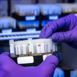 Revolução no diagnóstico: novo exame de HPV detecta quatro vezes mais casos de infecção