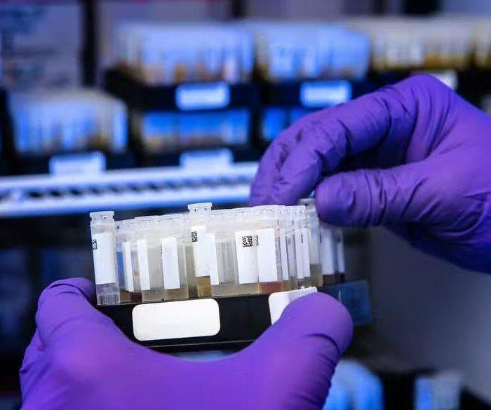 Revolução no diagnóstico: novo exame de HPV detecta quatro vezes mais casos de infecção