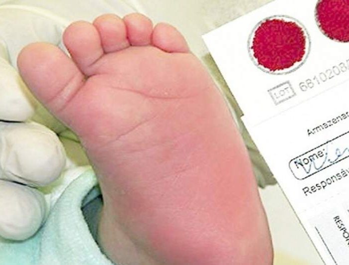 Teste do pezinho ausente gera consequências permanentes em crianças