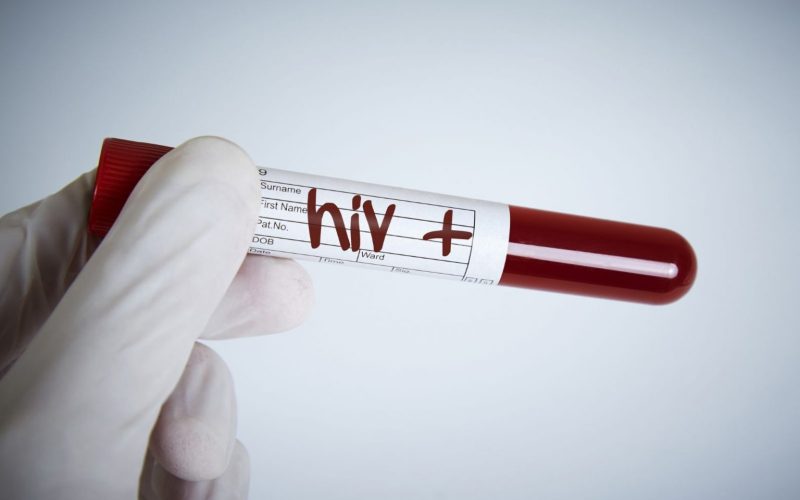 Queda global de 43% nos casos de HIV desde 2010, mas aumento é observado no Brasil