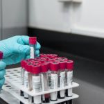 Exame de sangue revela potencial para antecipar risco de câncer de pulmão em até cinco anos antes do diagnóstico